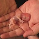 Канал Патология 