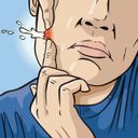 Канал Акнефобия | Прыщи